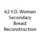 When you think all doors are closed, God opens a secret door no one knew existed,” Dr. Jay Orringer was that secret door for me. He worked miracles in my complex breast cancer case, saving my life and correcting the mistakes of other doctors.