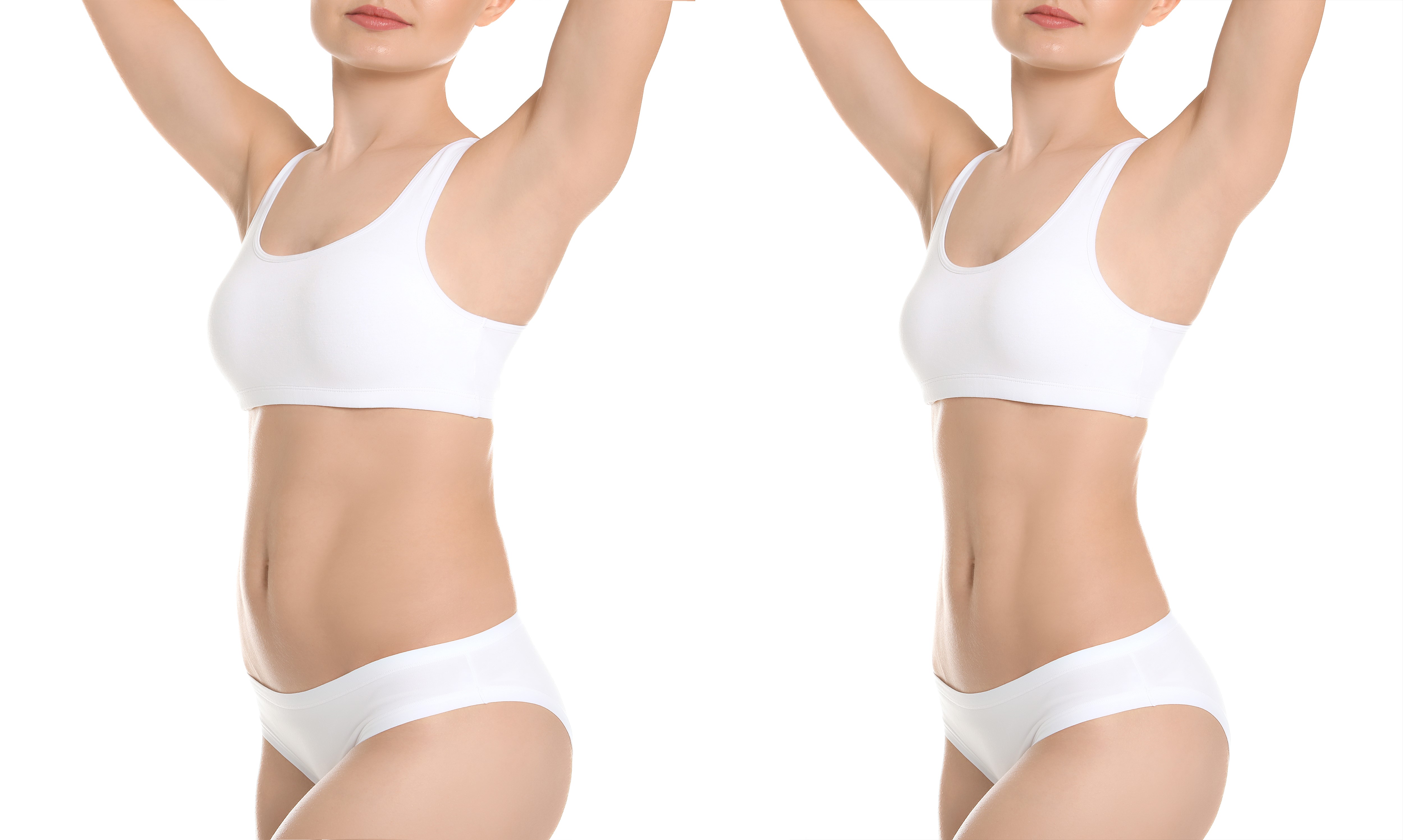 Where Does Liposuction Work Most Effectively? - Beverly Hills